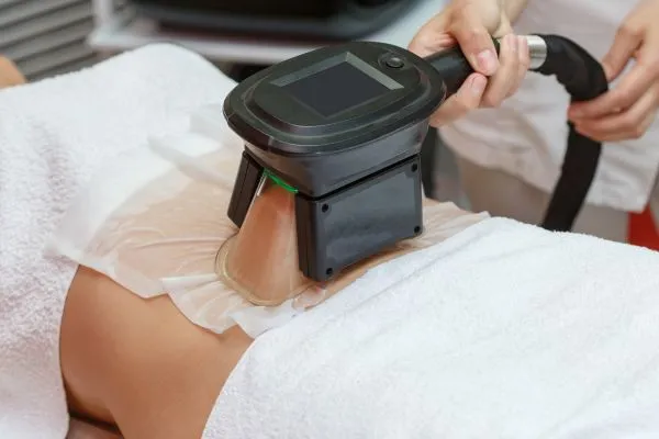 Image of person having fat freezing treatment to help weight gain Greenhead