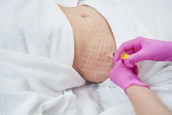 image of fat dissolving injections on love handles to help combat weight gain Greenhead