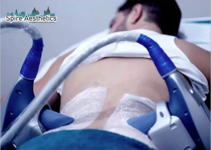 Man having fat freezing treatment done on love handles before a competitions Greenhead to create a sculpted look.